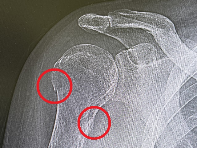 ��r�T�􍜐܁~2�ӏ�